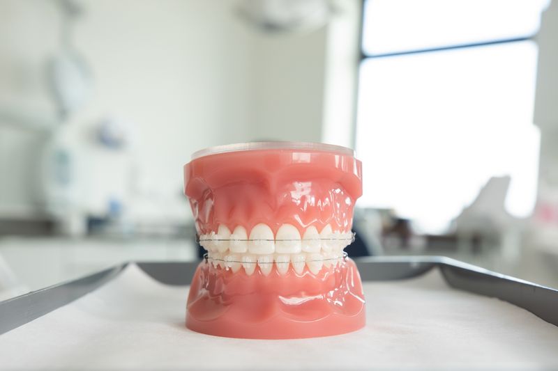 Ceramic Braces Cost